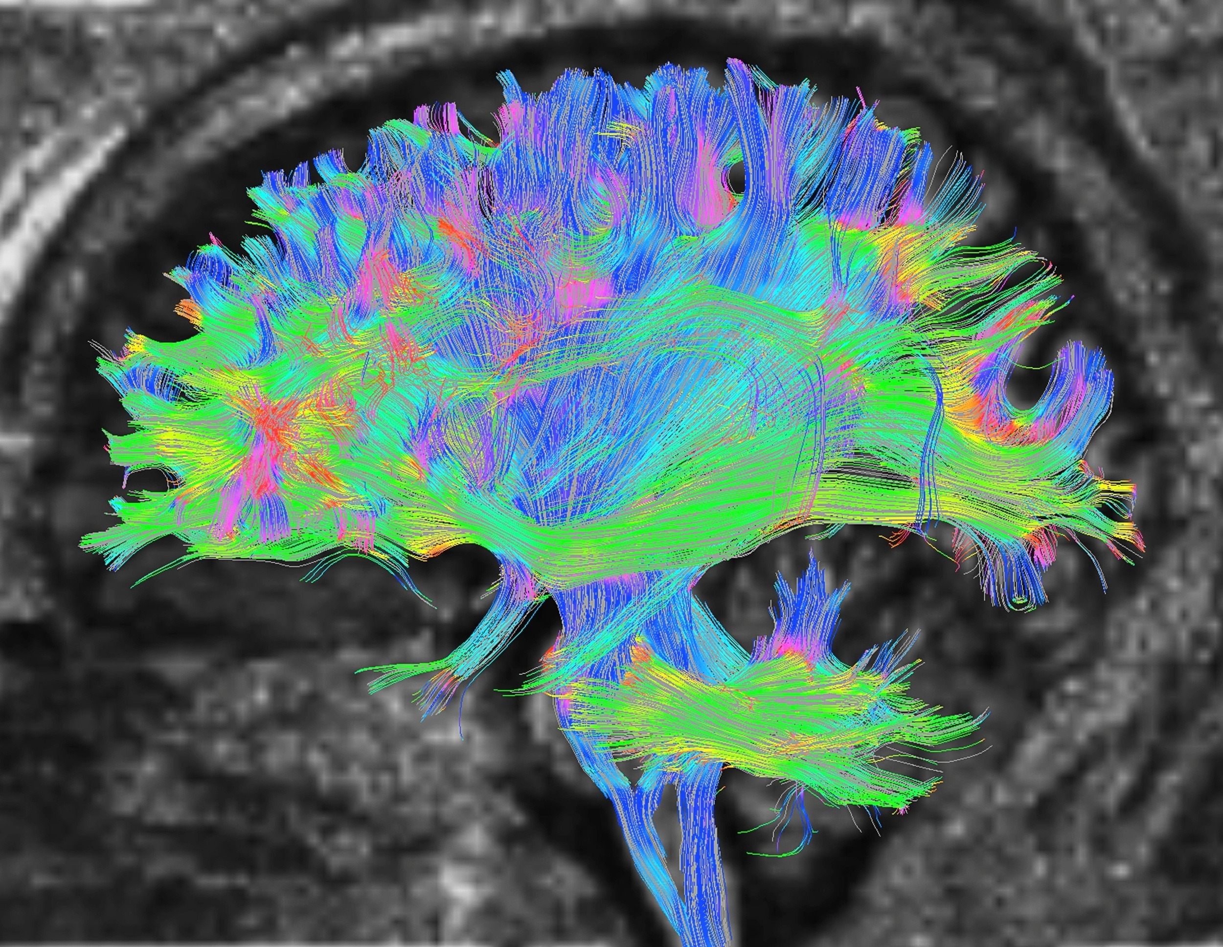 Why our brains react to scary sounds before we know what they are