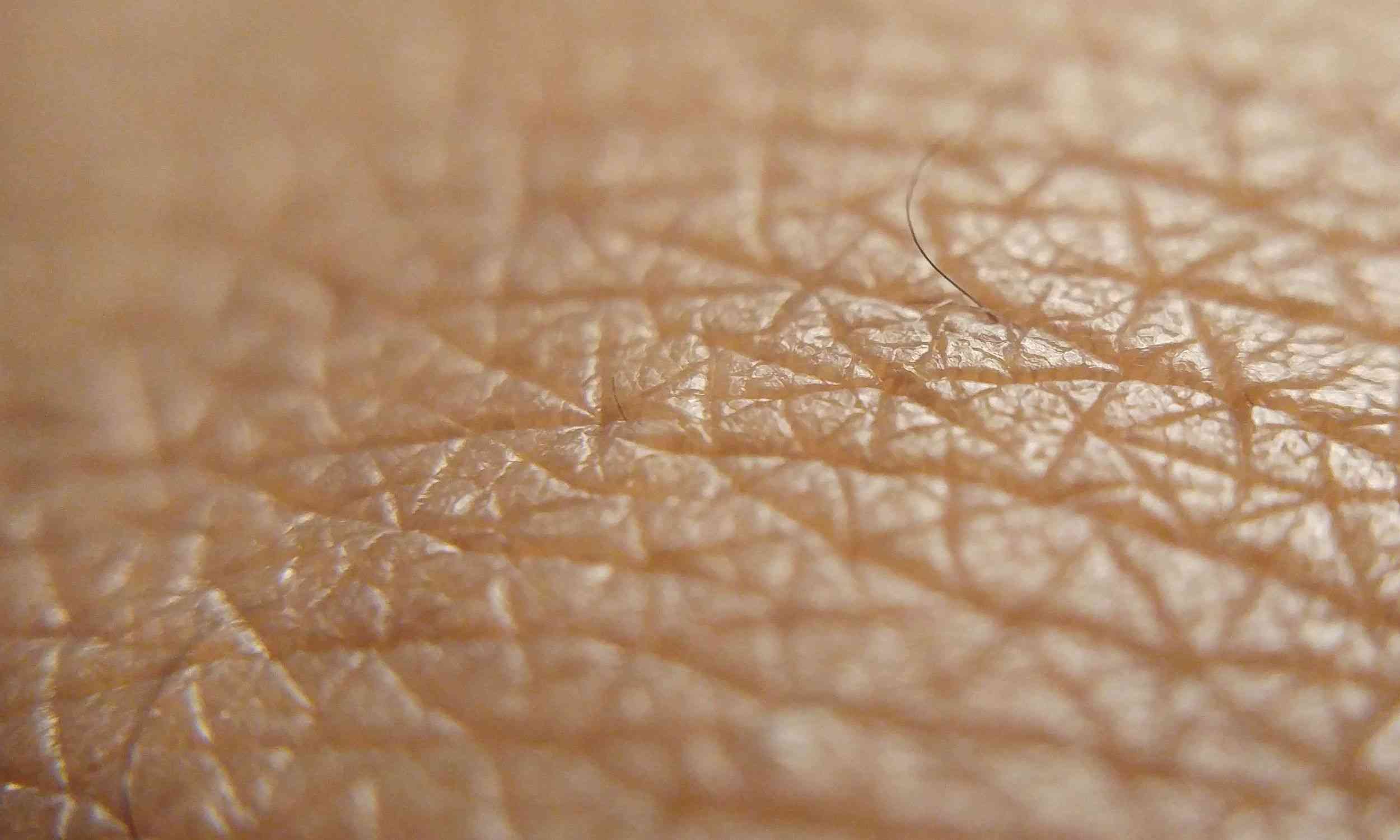 Skin holds an unexpected trick to bolster the body’s defenses (via earth.com)