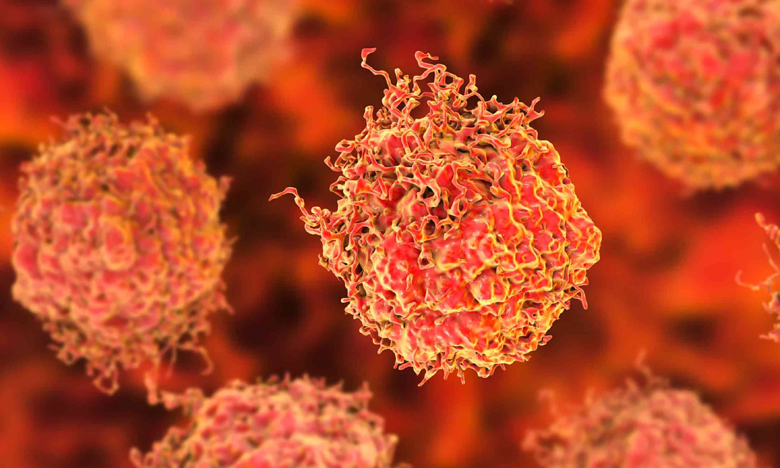 Low testosterone levels may help flag high-risk prostate cancer early