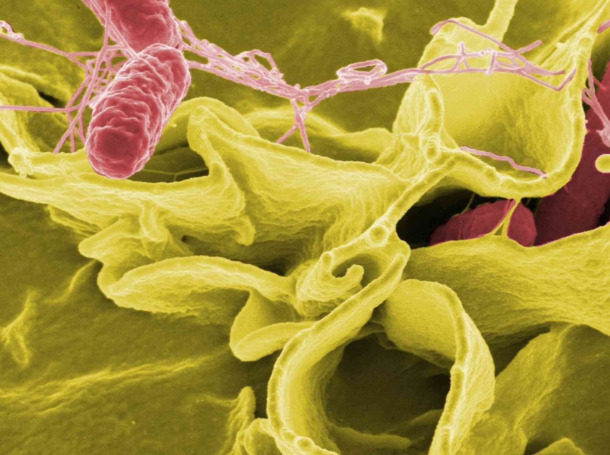 Running reshapes gut and brain bacteria in unexpected ways