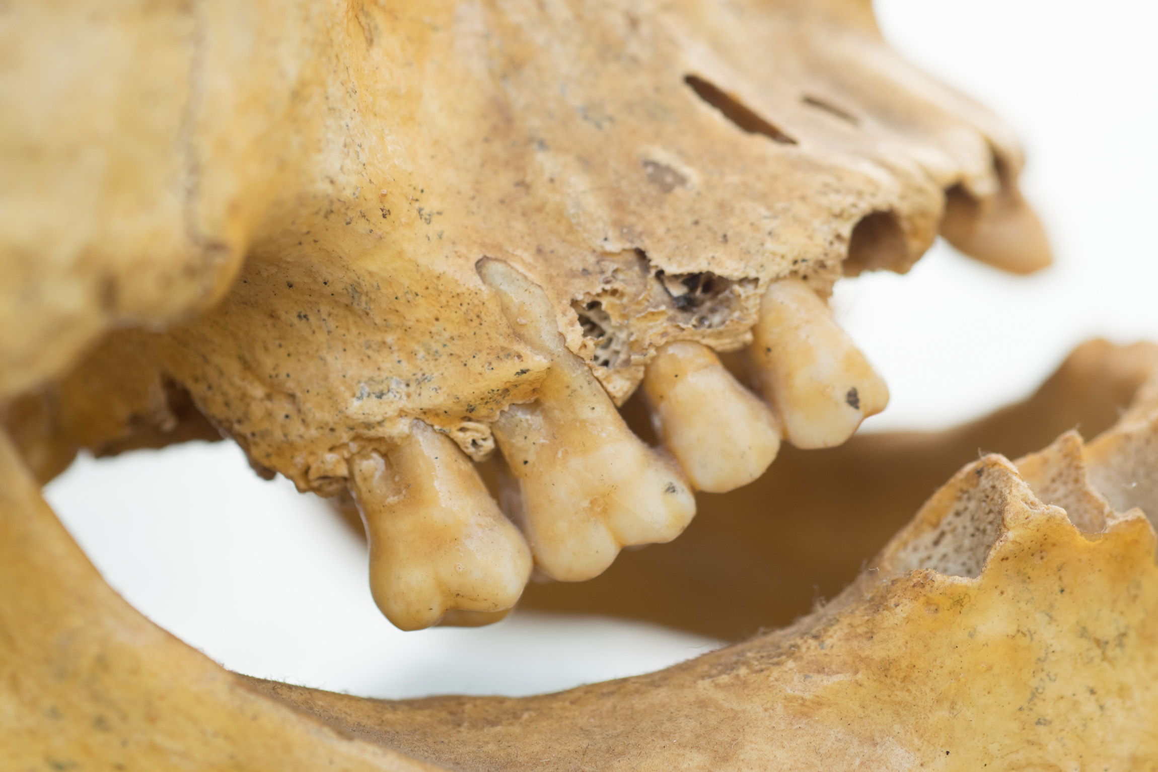 Tooth enamel of ancient Sumerians reveals unexpected diet