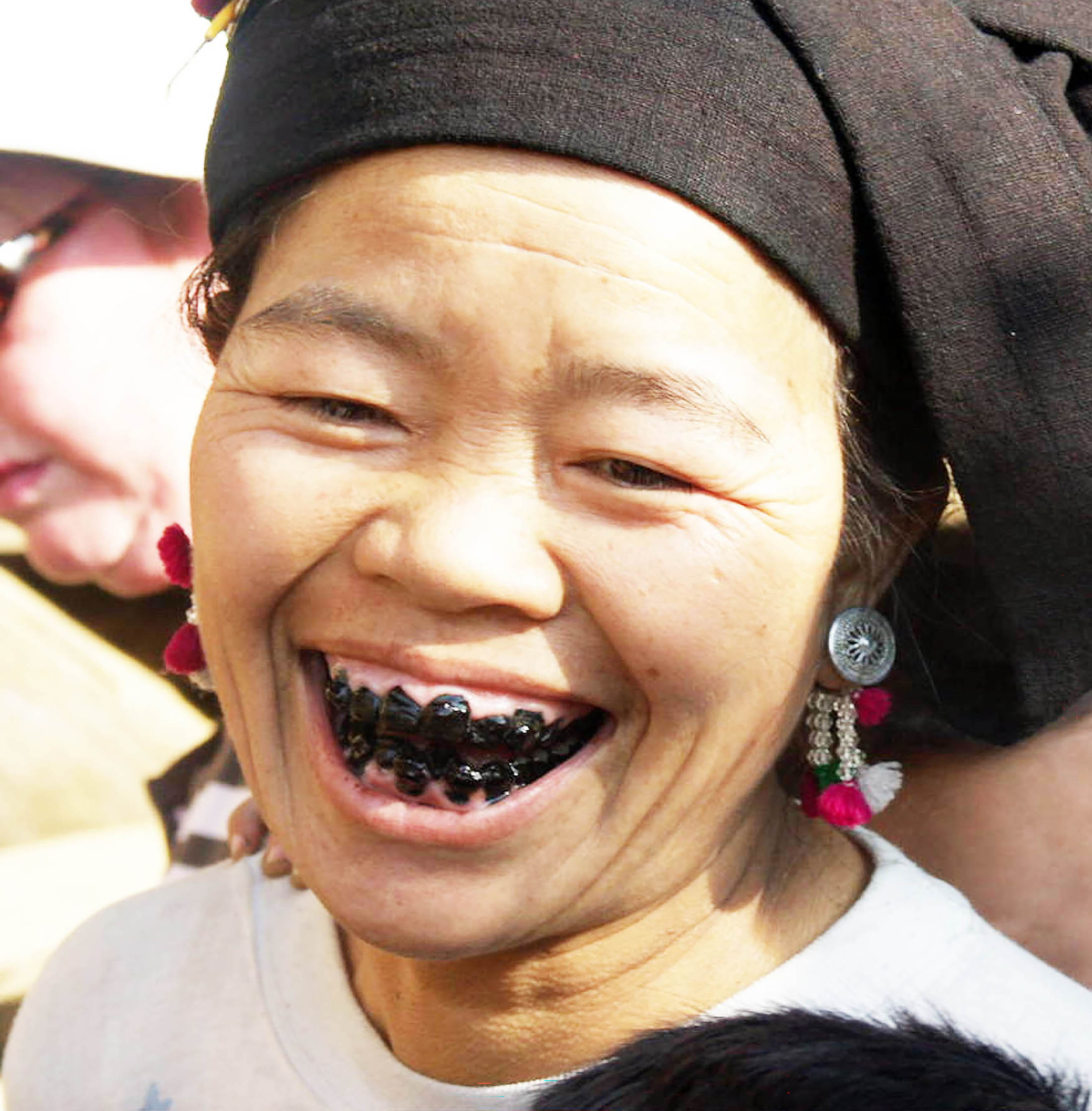 Tooth blackening beauty trend in Vietnam is found by scientists to have originated 2,000 years ago