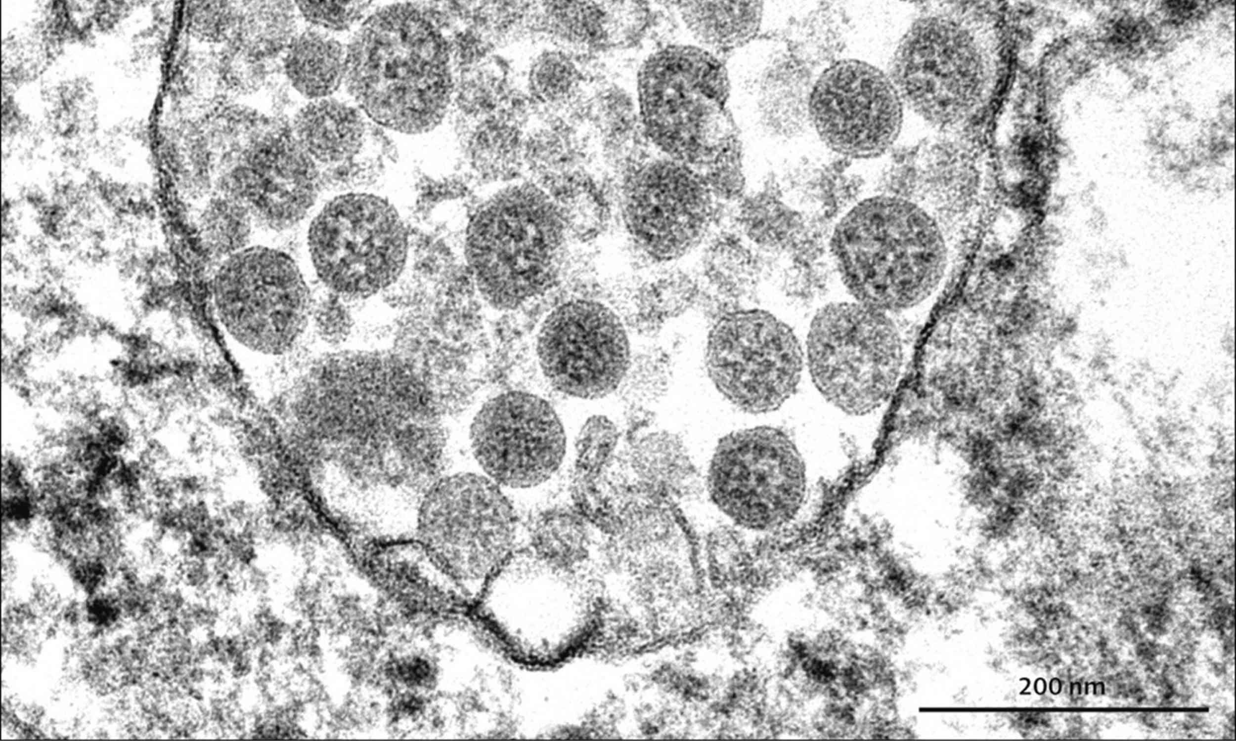 Study challenges how pandemics like COVID begin