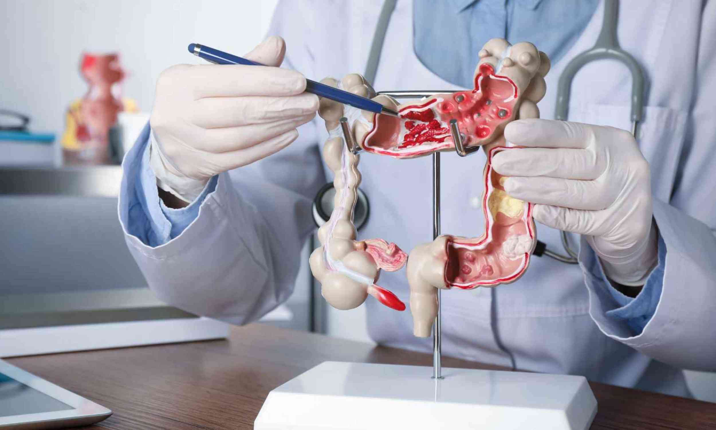 Scientists found a Parkinson’s warning sign hiding in healthy people’s gut bacteria