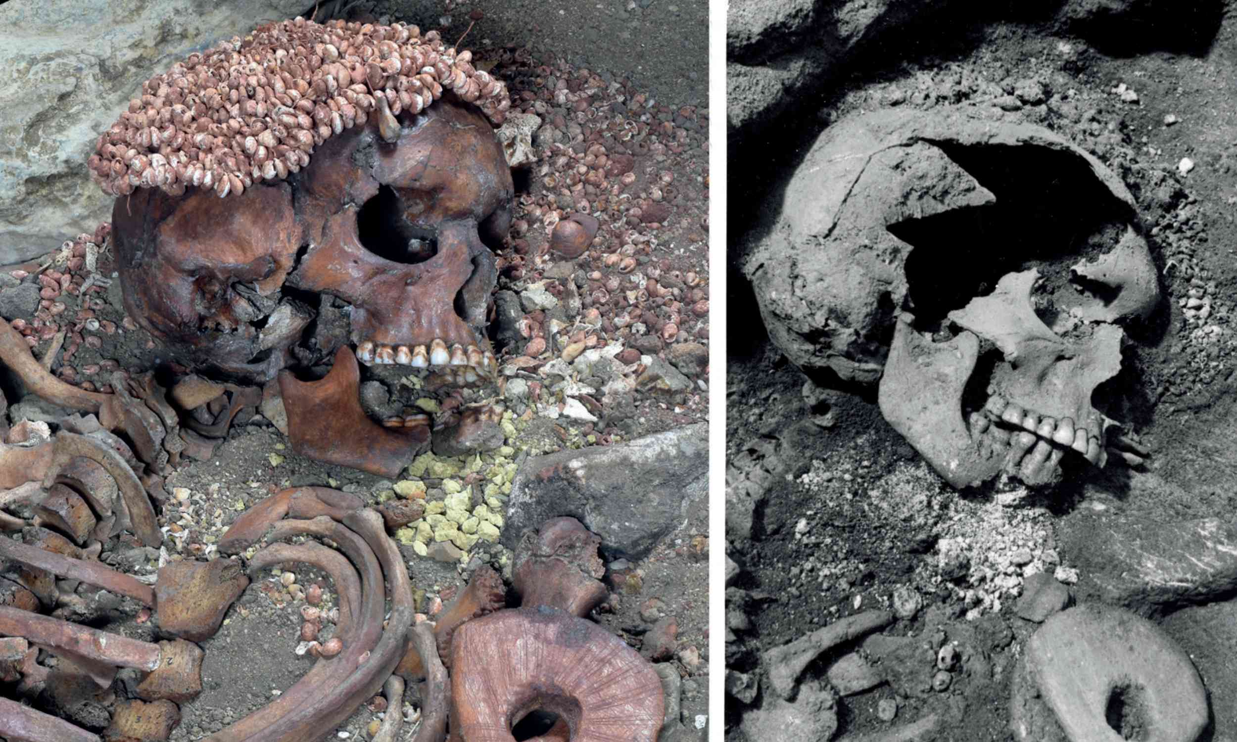 What researchers have just discovered in the skeleton of a Paleolithic teenager buried 28,000 years ago suggests a very brutal death