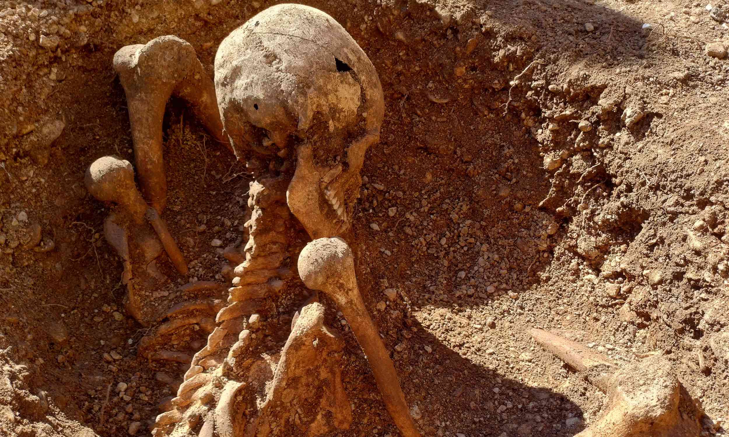 Skeleton discovered in France was buried in a sitting position inside a circular pit, with no clear explanation