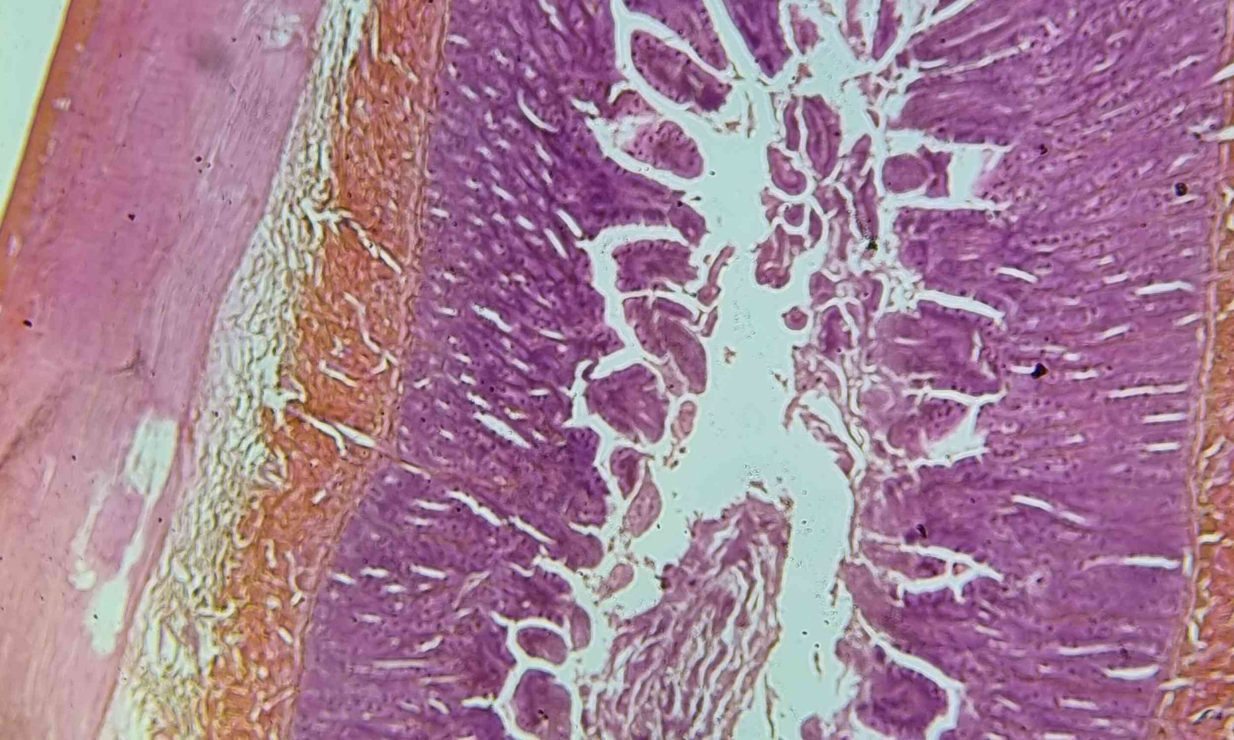 Scientists uncover gut signals that may improve early cancer detection