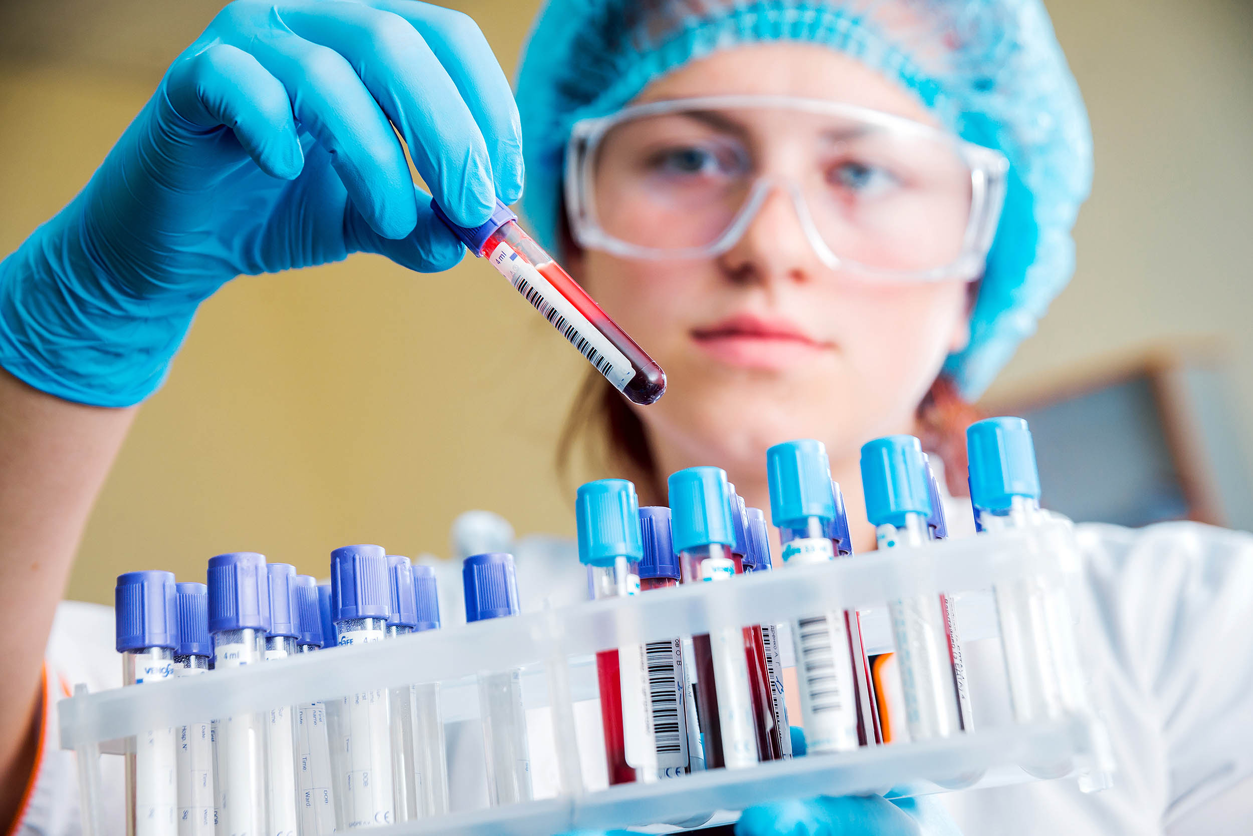 Routine blood marker may warn of Alzheimer’s risk years before symptoms appear