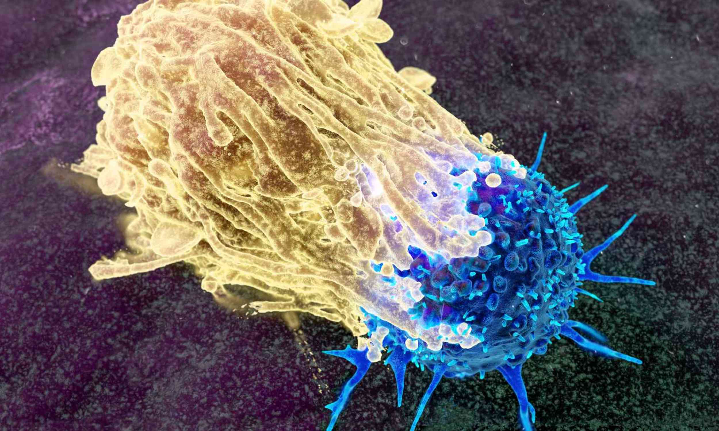 Hidden virus inside gut bacteria may explain a major colon cancer mystery