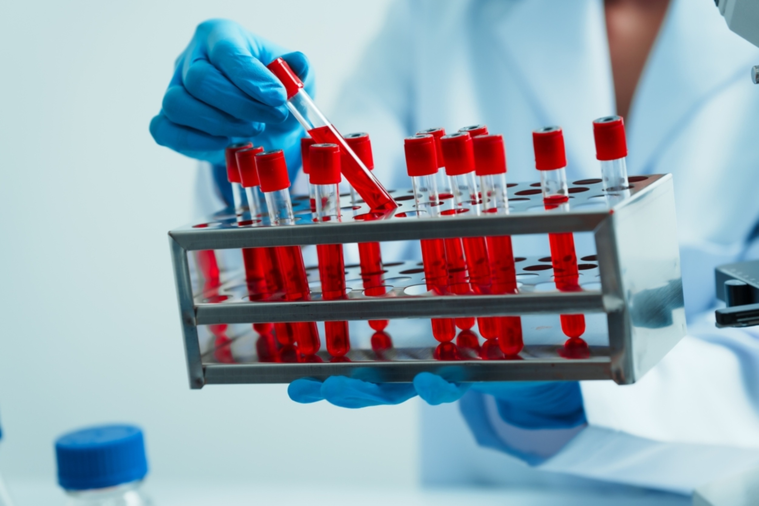 Method mass produces cancer hunting immune cells