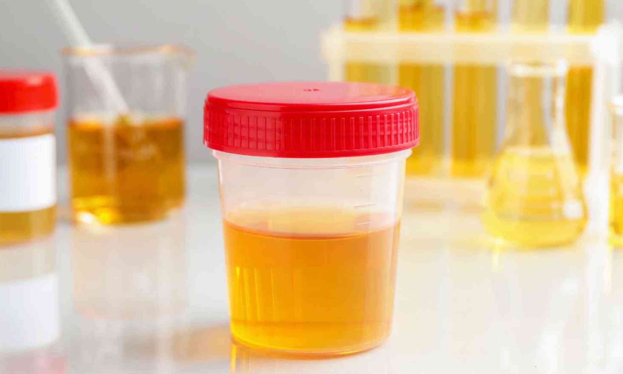 Eating foods not wrapped in plastic dramatically cuts toxic chemicals found in urine