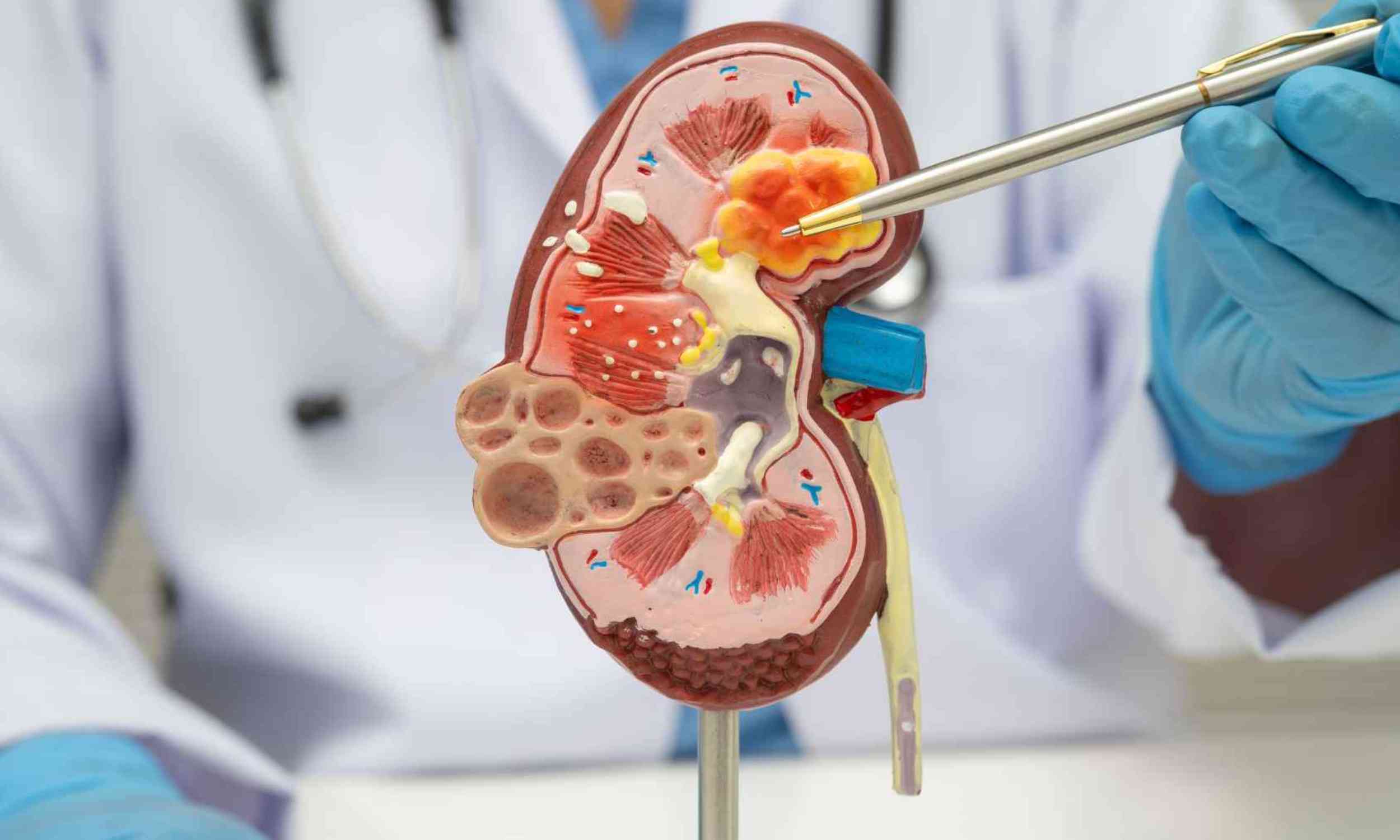 Crohn's patients changed to this diet, and most noticed significant improvement - Earth.com