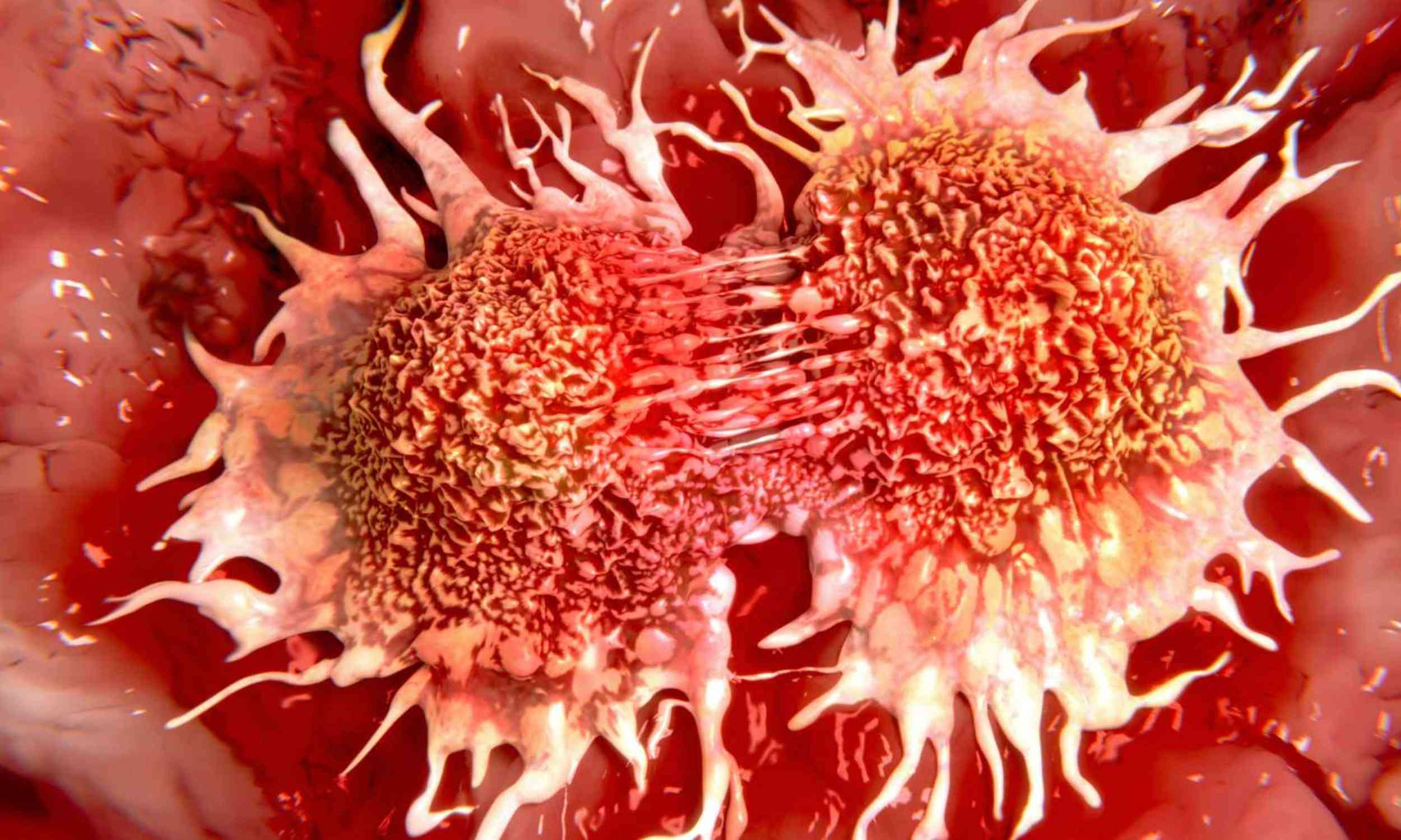 Pancreatic cancer may have a fatal addiction, and scientists found a way to cut it off