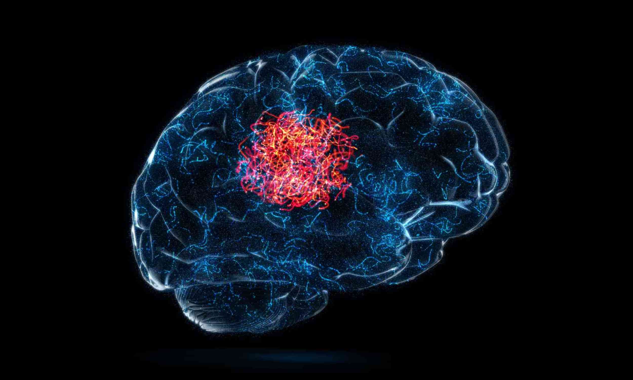 New biodegradable patch fights brain tumor recurrence from the inside