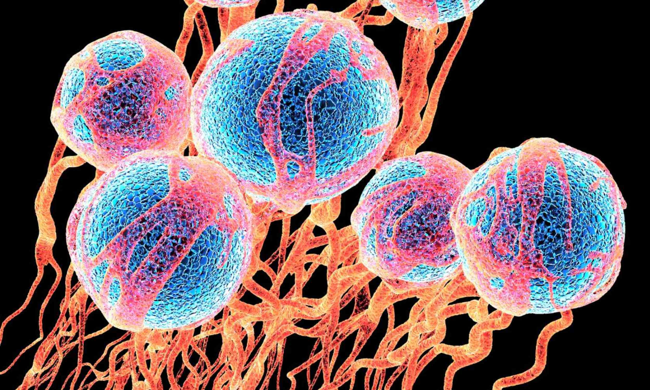 New drug shown to be highly effective against one of the deadliest forms of cancer