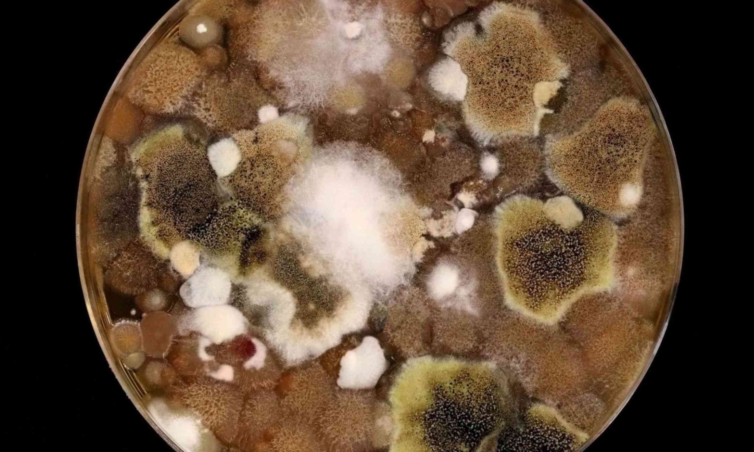 City soil may be building stronger antibiotic resistance networks underground