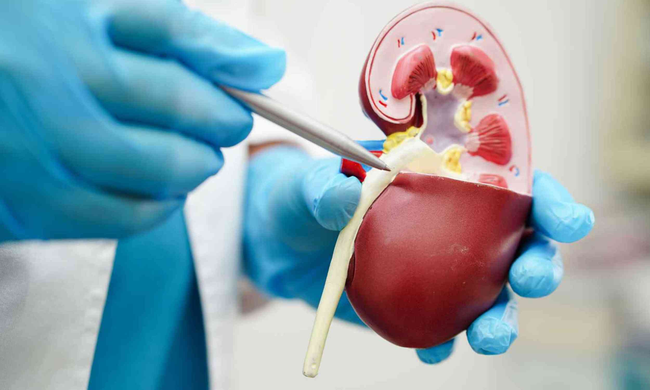 Cancer therapy may unlock kidney transplants for patients who had no match
