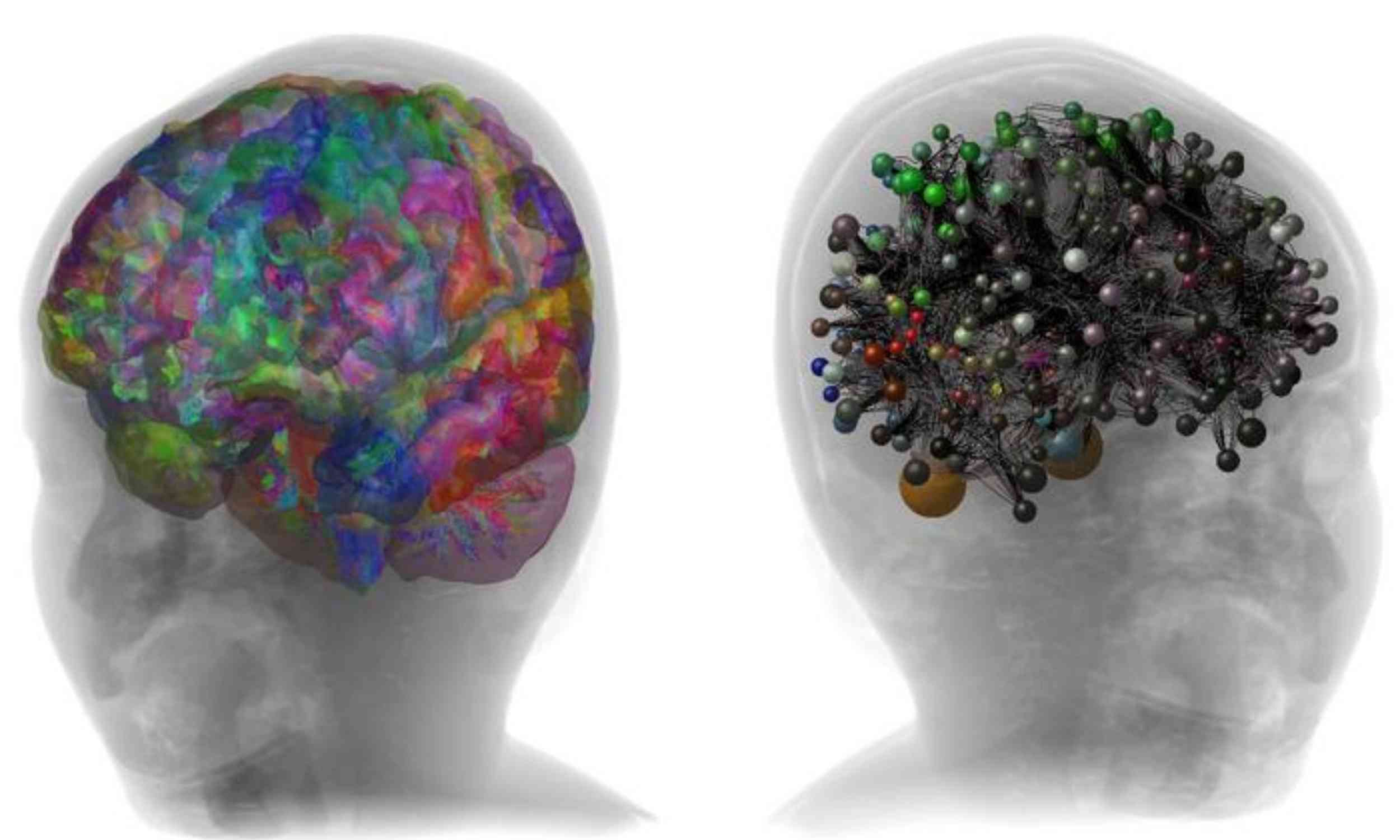 Scientists built a digital twin of a child’s brain, and it may reveal clues about autism