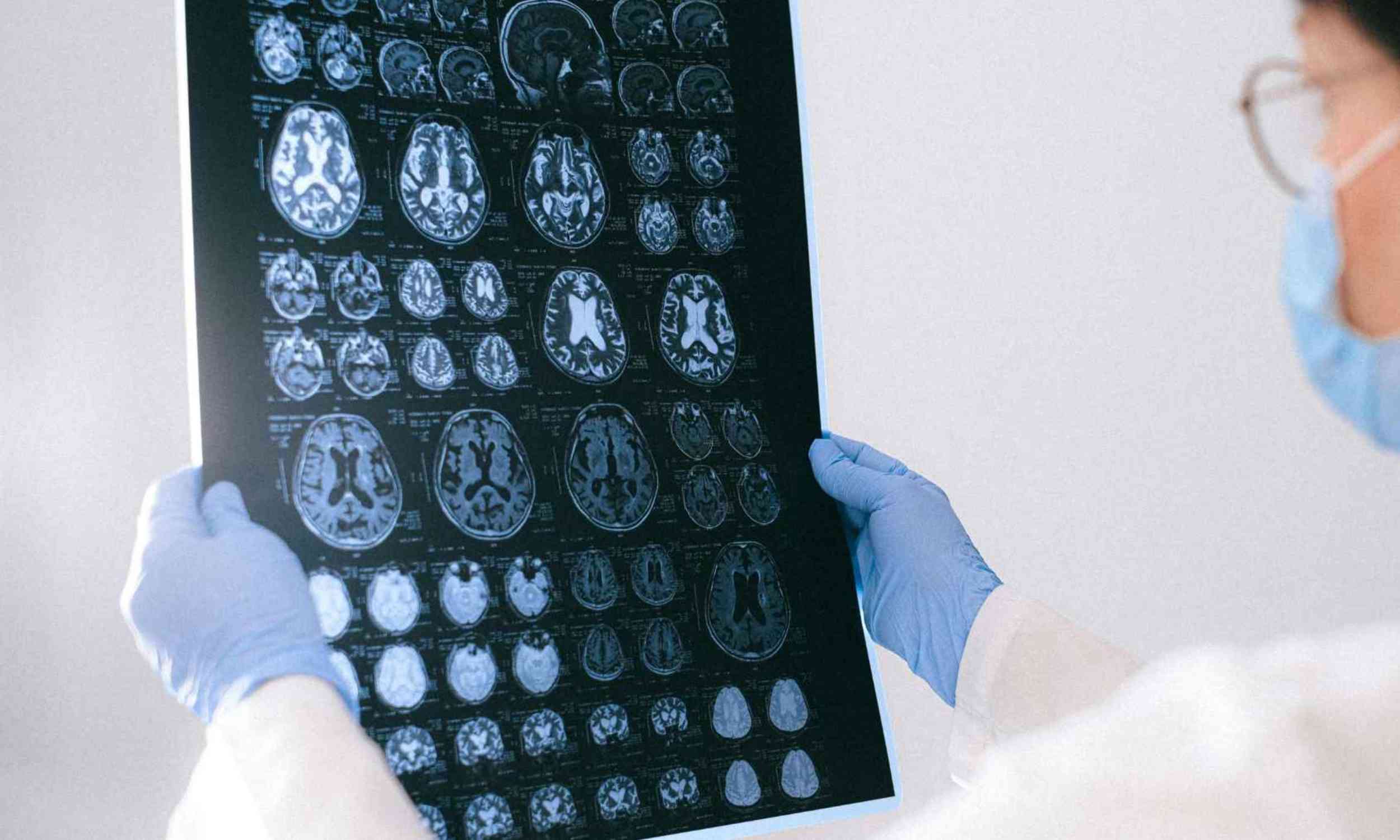 A common joint supplement may hide a risk for vulnerable brains