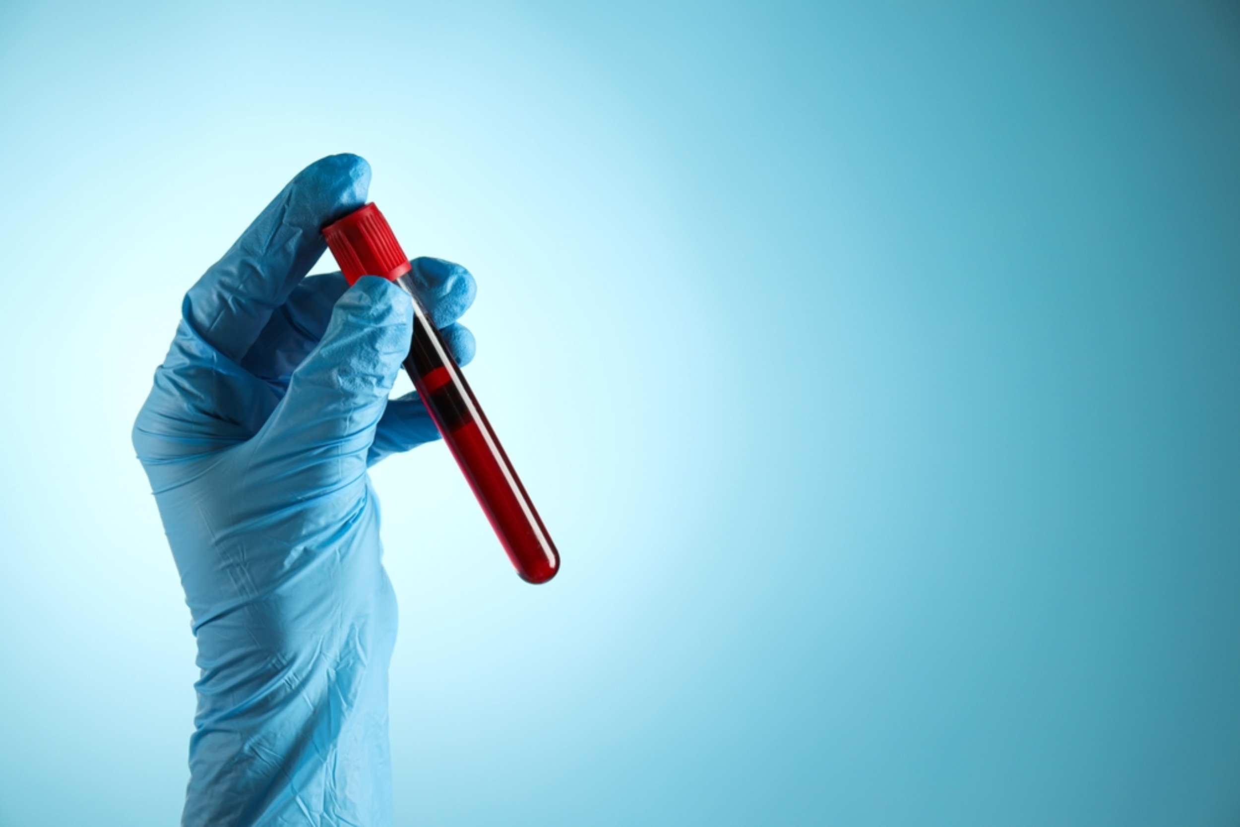 Blood test may spot cancer years early