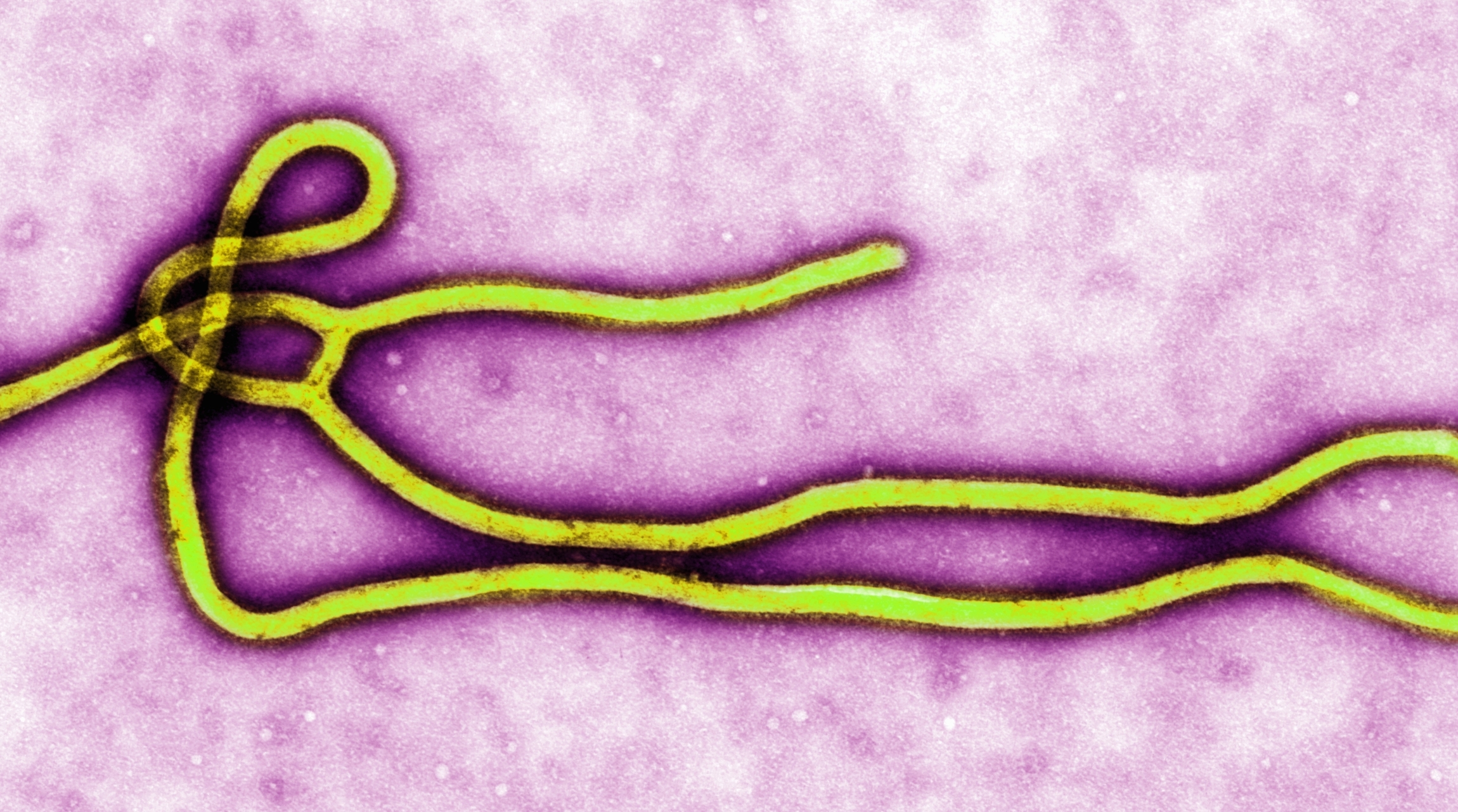Ebola stays infectious in human brain tissue for 120 days, lab-grown organoids show why survivors relapse and old outbreaks reignite