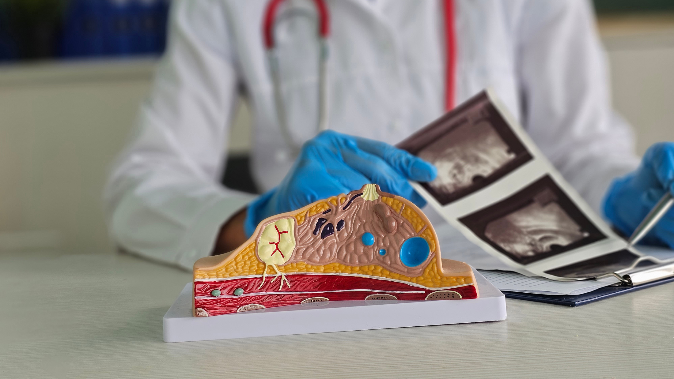 Scientists identify dozens of potential treatment targets for aggressive breast cancer
