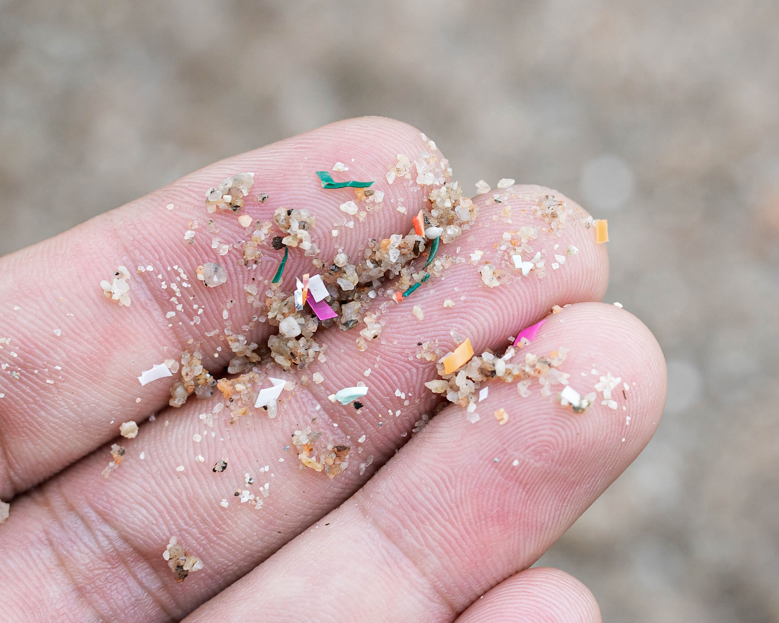 Microplastics have reached one of the body's most vital places