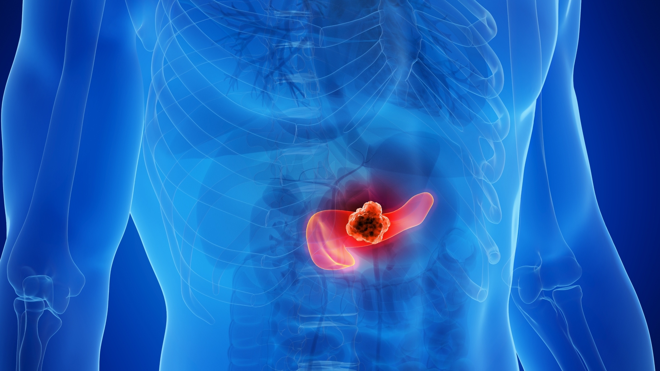 New vaccine trains the body to fight pancreatic cancer before it starts