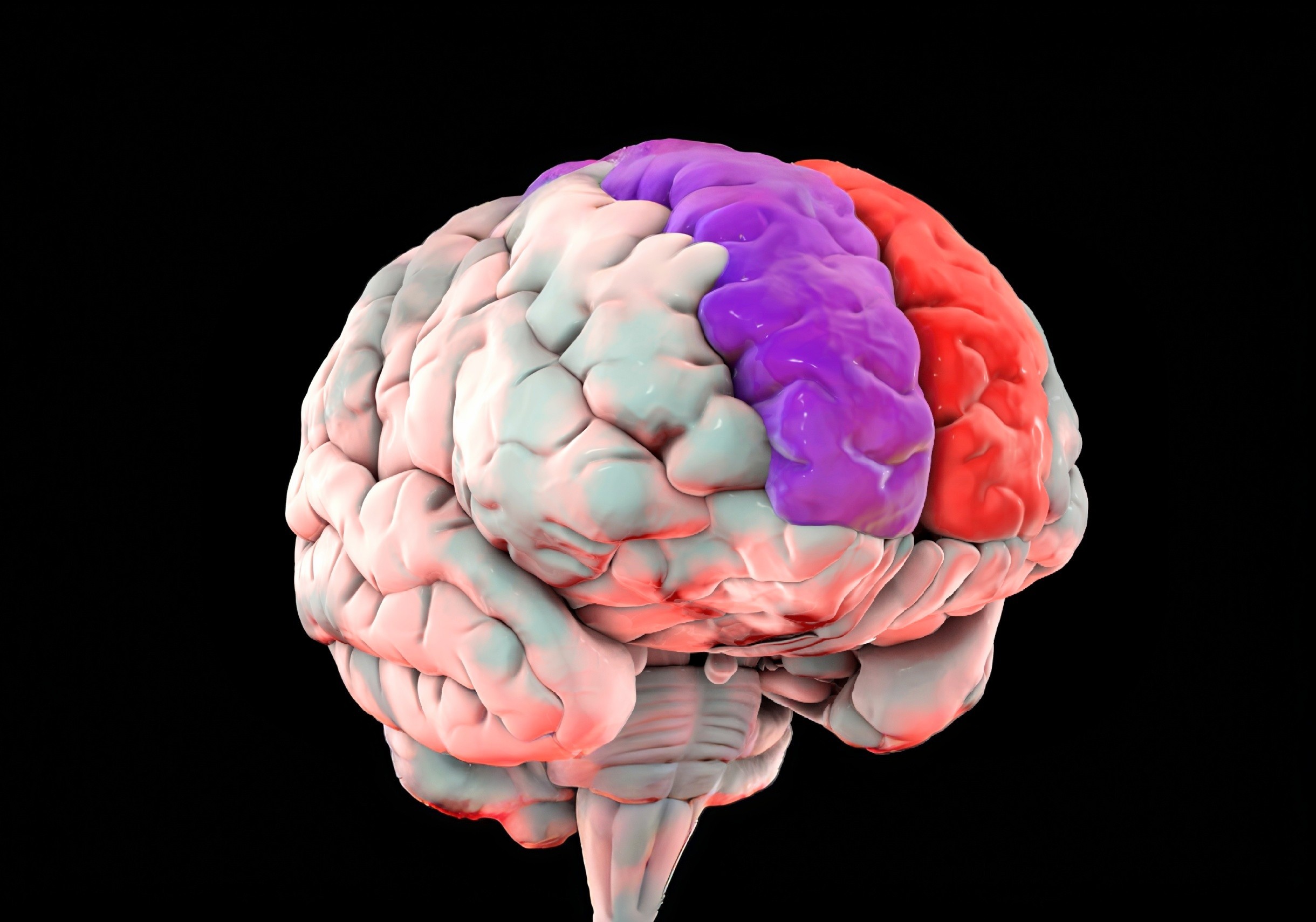Your brain changes shape as its overall health improves