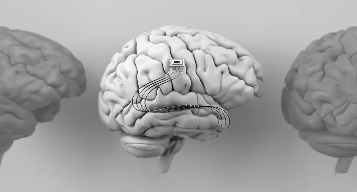 Thoughts became words: how a brain implant gave him back his life