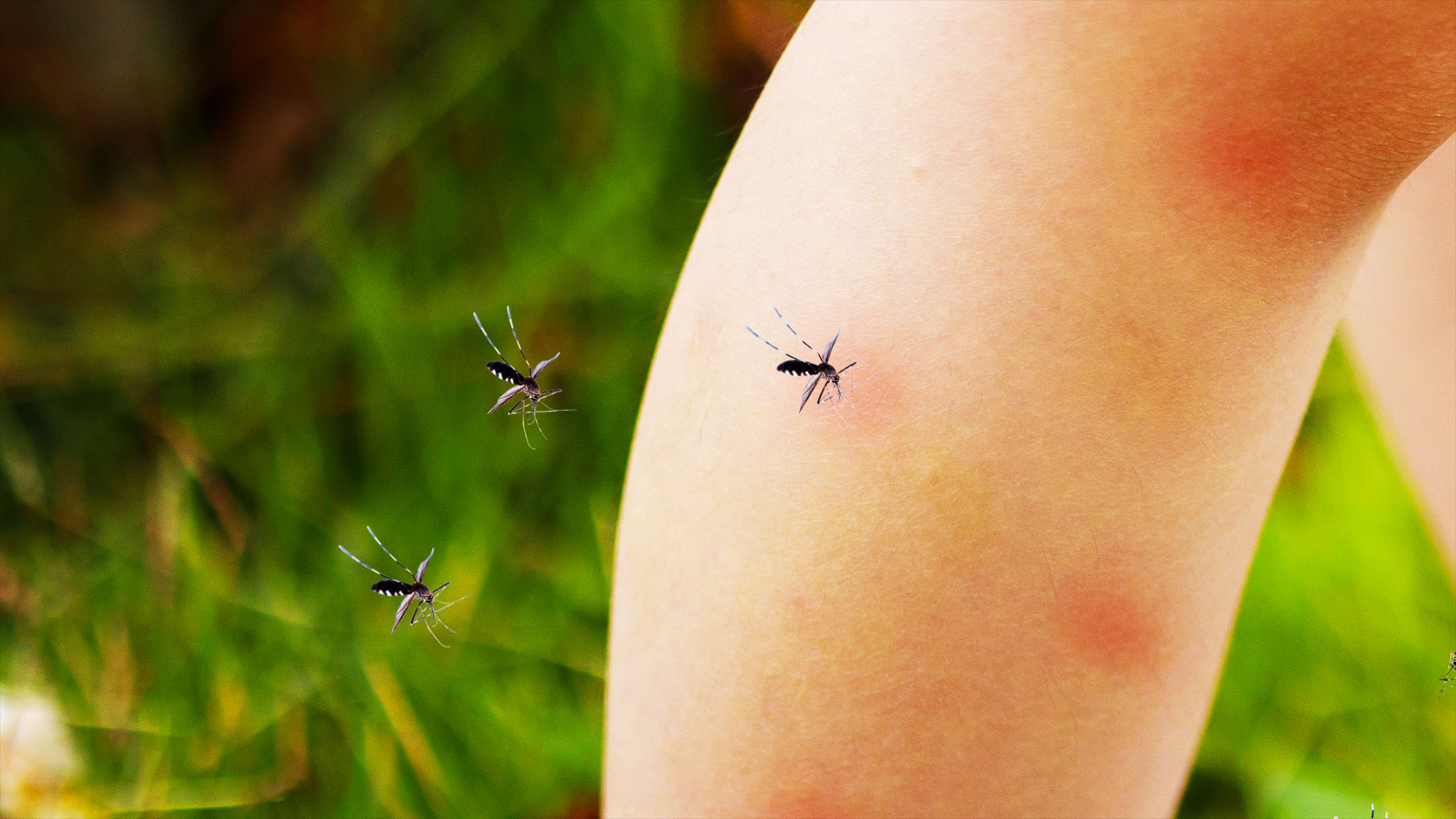 What makes you a mosquito magnet? Scientists tested 450 people to find out